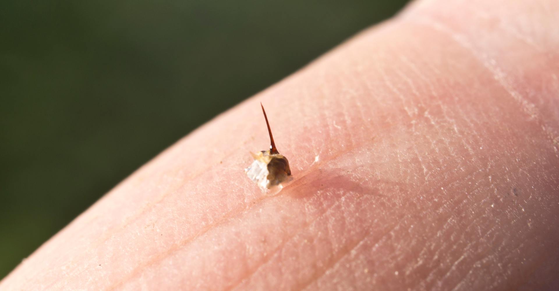 Piqûre de guêpe ou d'abeille : les premiers soins