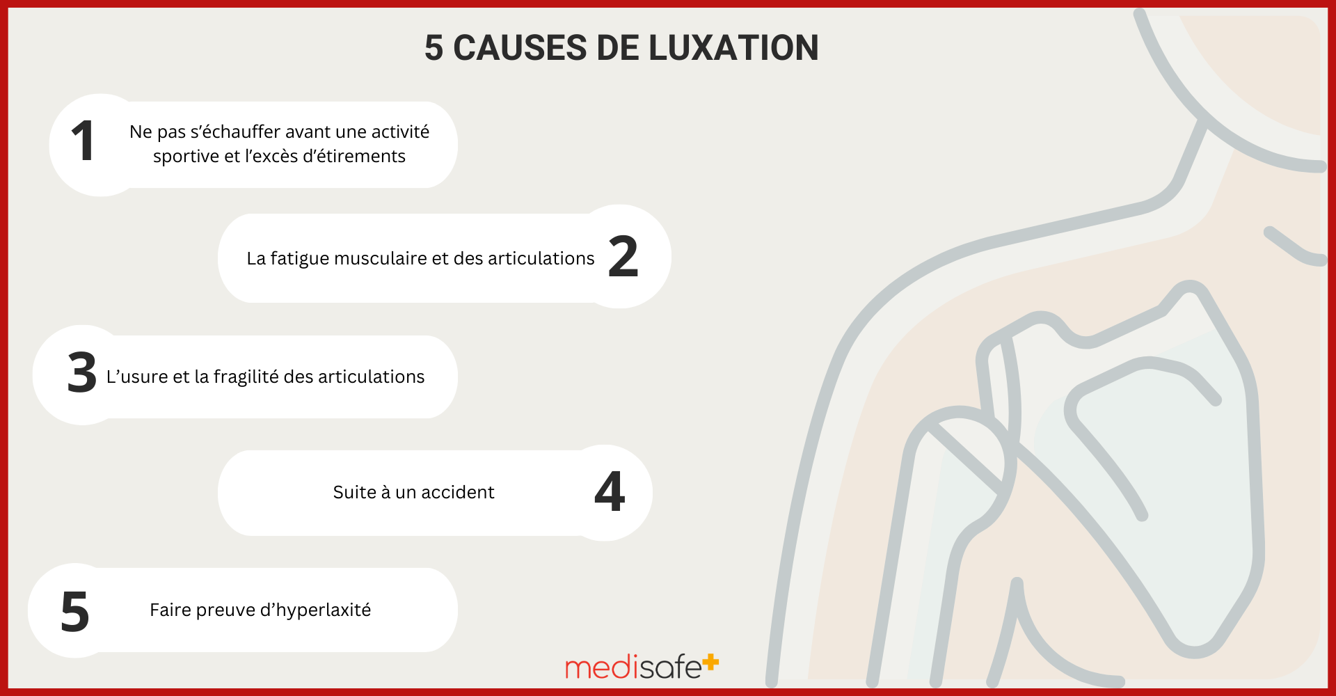 causes-luxation