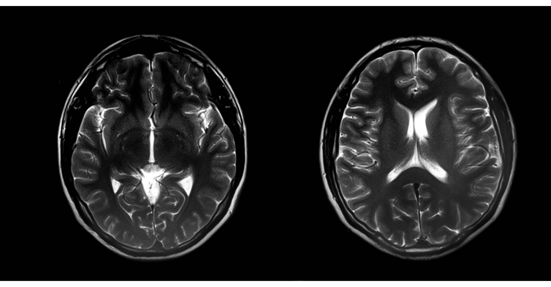 scanner-cerveau