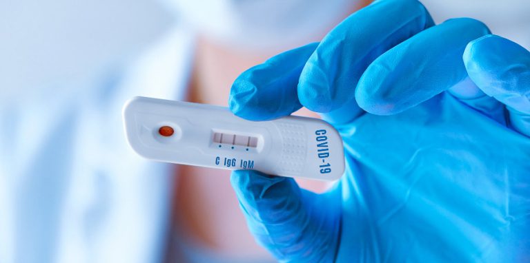 test covid antigenique 19 autotest pharmacie
