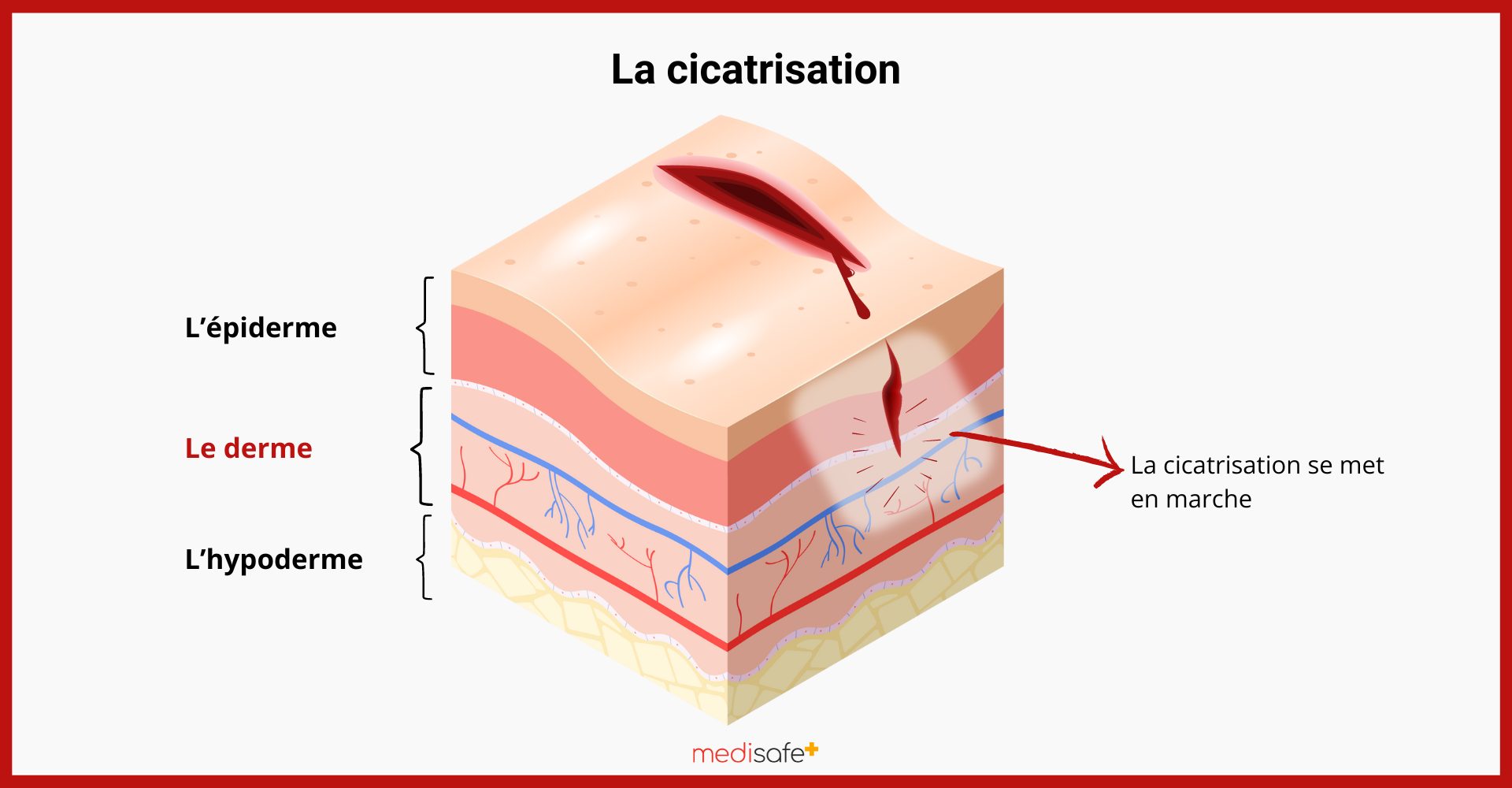 comment-cicatriser-plus-vite