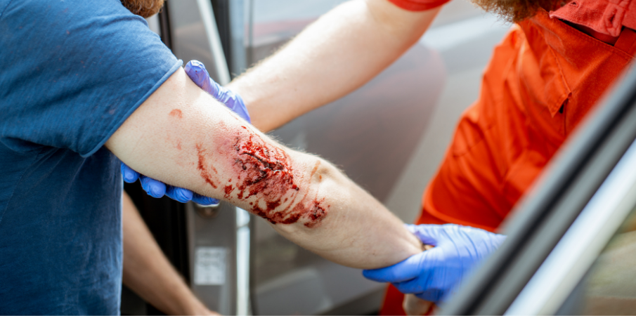 sang plaie hemorragie blessure