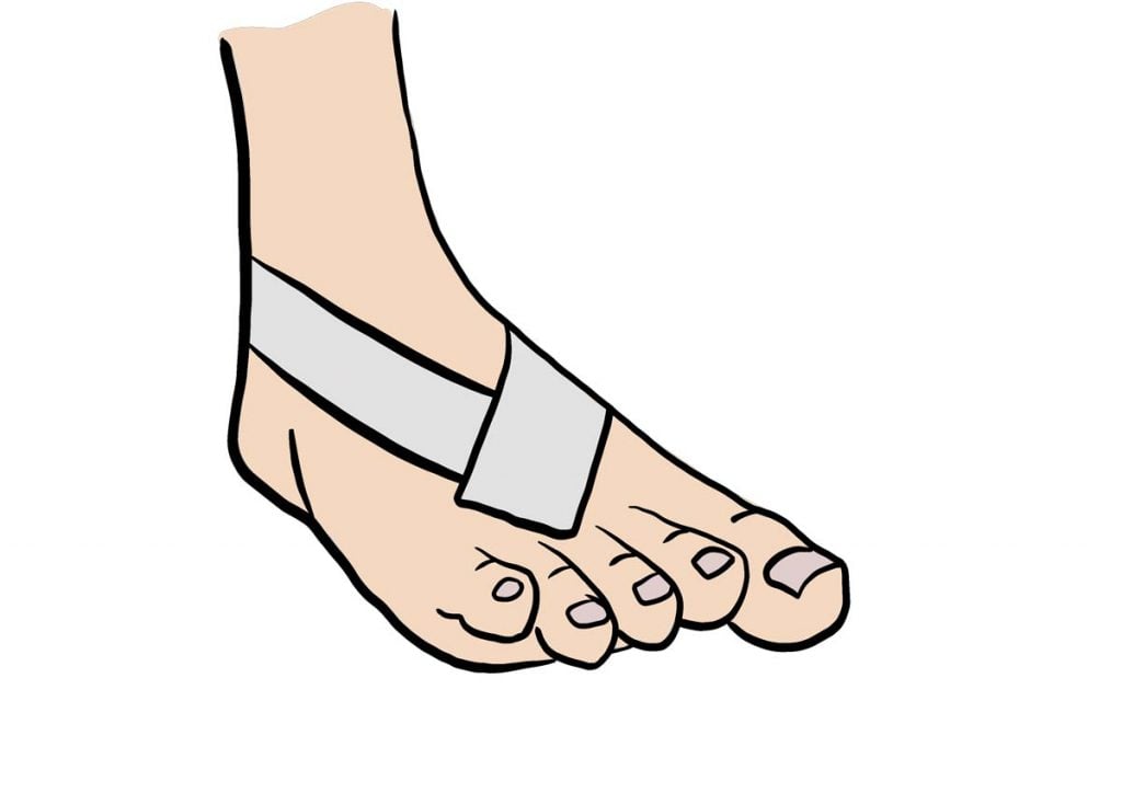 illustration d'un bandage strap au pied
