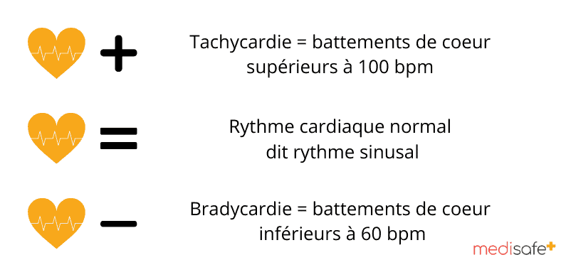 Tachycardie-Battements-de-coeur-superieurs-a-100-bpm