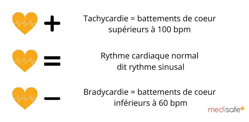 Tachycardie-Battements-de-coeur-superieurs-a-100-bpm Tachycardie-Battements-de-coeur-superieurs-a-100-bpm