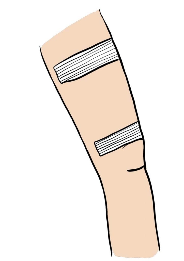 bandage-claquage-cuisse-724x1024