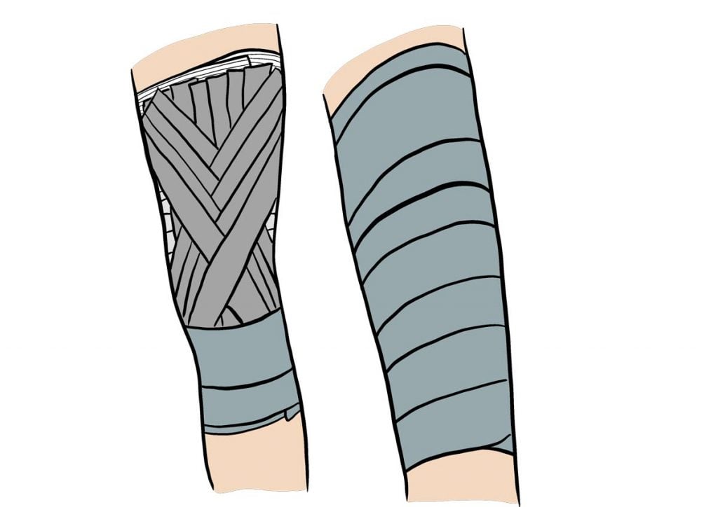 bandage-cuisse-1024x724