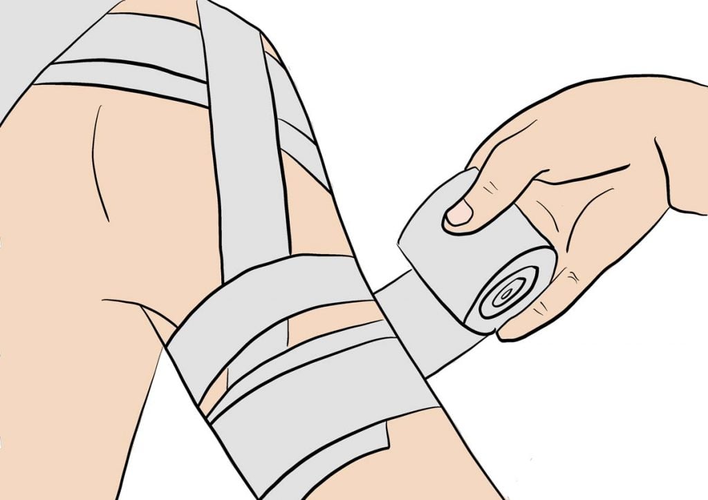 illustration strapping d'une épaule