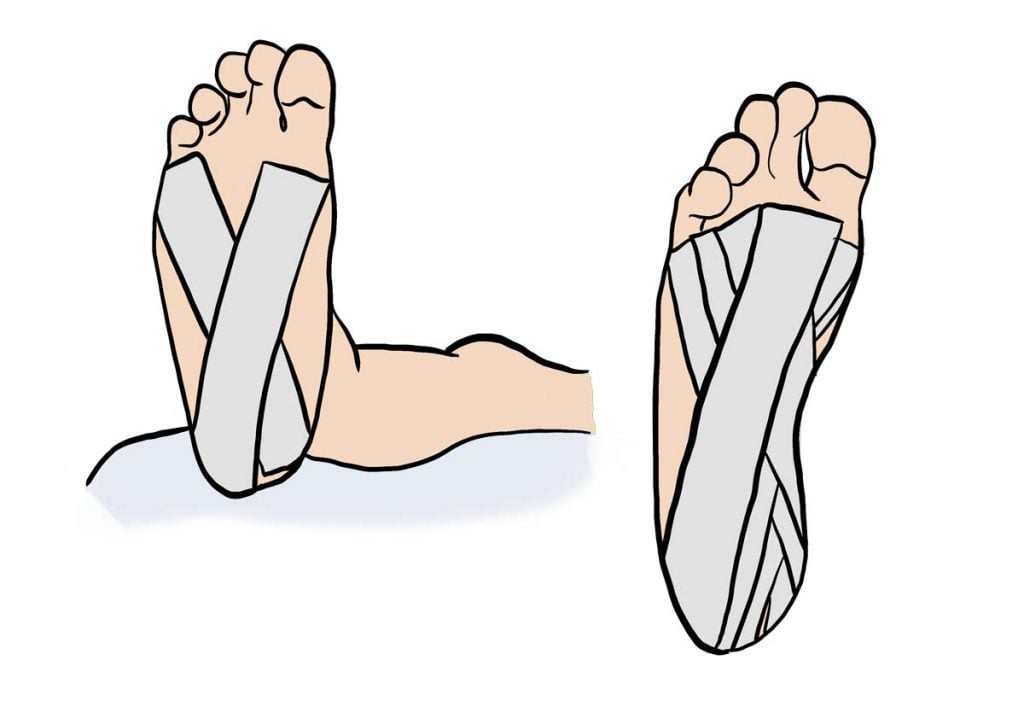 illustration d'un bandage strap au pied
