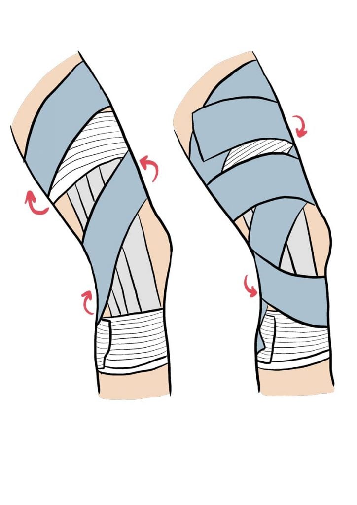 Strapping genou : comment faire un strap pour tendinite ou entorse ?