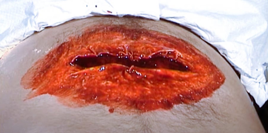 MaqPro : maquillage d’une « Plaie à l’abdomen avec éviscération »
