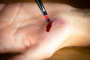 fausse-blessure-plaie-300x200 fausse-blessure-plaie-300x200