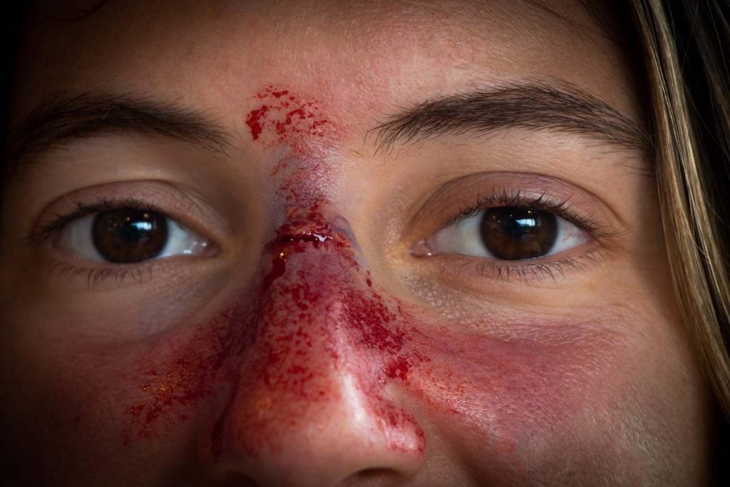 maquillage d'un nez cassé