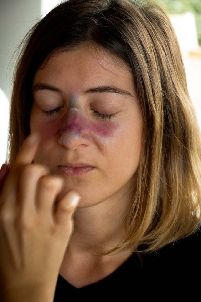 maquillage d'un nez cassé