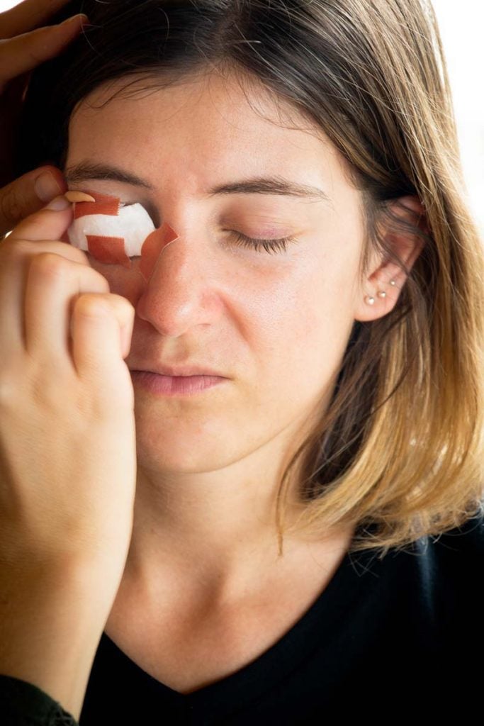 maquillage d'un oeil tuméfié