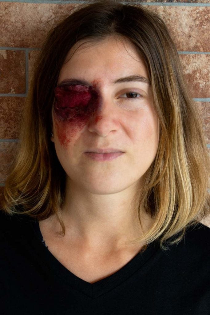 maquillage d'un oeil tuméfié