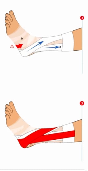 strap-Entorce-cheville_contension-souple_3 strap-Entorce-cheville_contension-souple_3