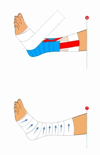 strap-cheville-foot strap-cheville-foot
