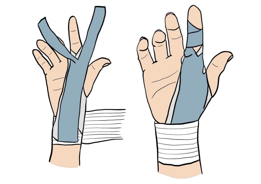 Strapping du doigt : comment le réaliser ?