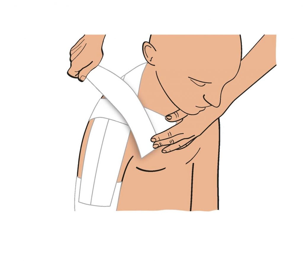 strapping entorse épaule