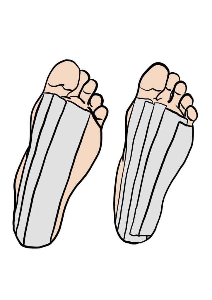 illustration d'un strapping sous la voute plantaire