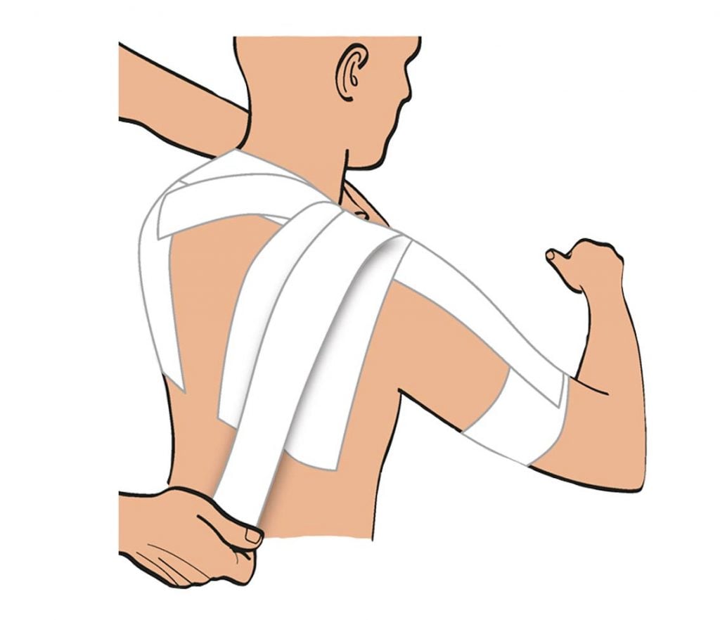 strap entorse épaule