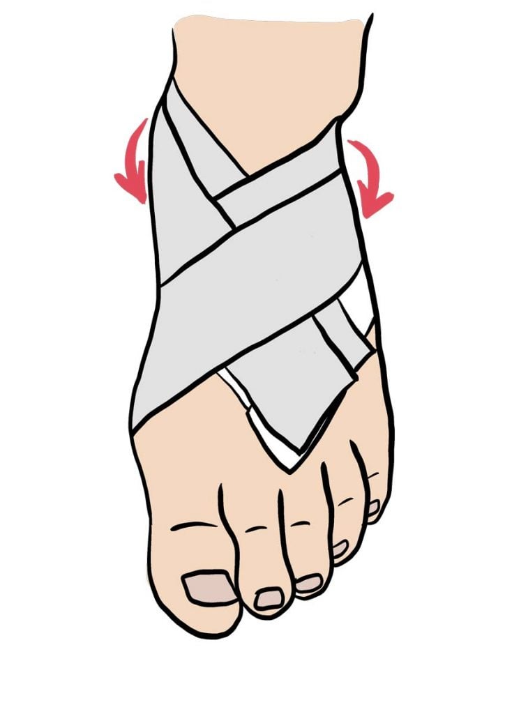 illustration d'un bandage strap au pied