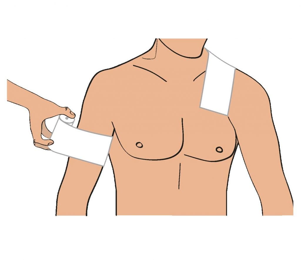dessin de strapping d'épaule