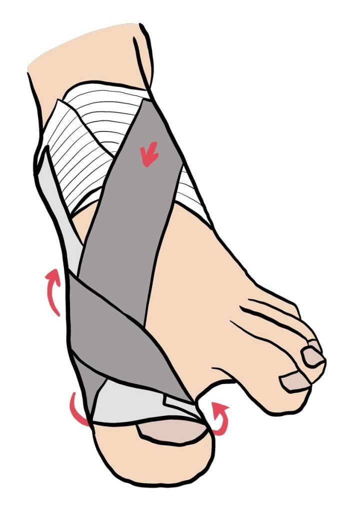 illustration strapping orteil