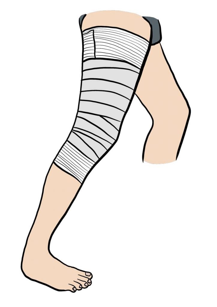 Strapping cuisse : comment le réaliser ?