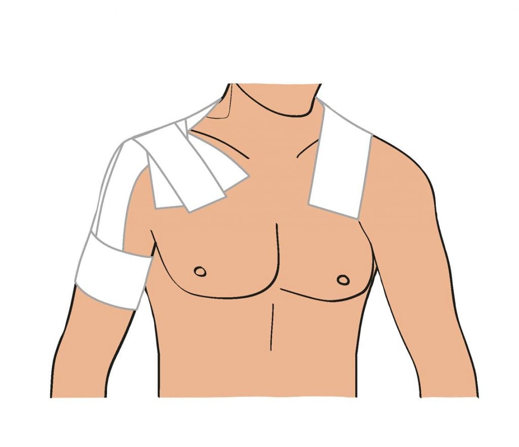strapping entorse épaule