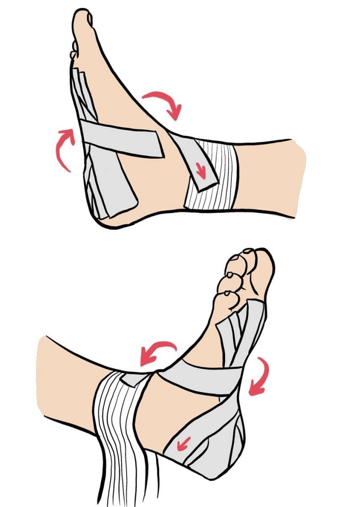 illustration d'un bandage strap contre l'entorse du pied