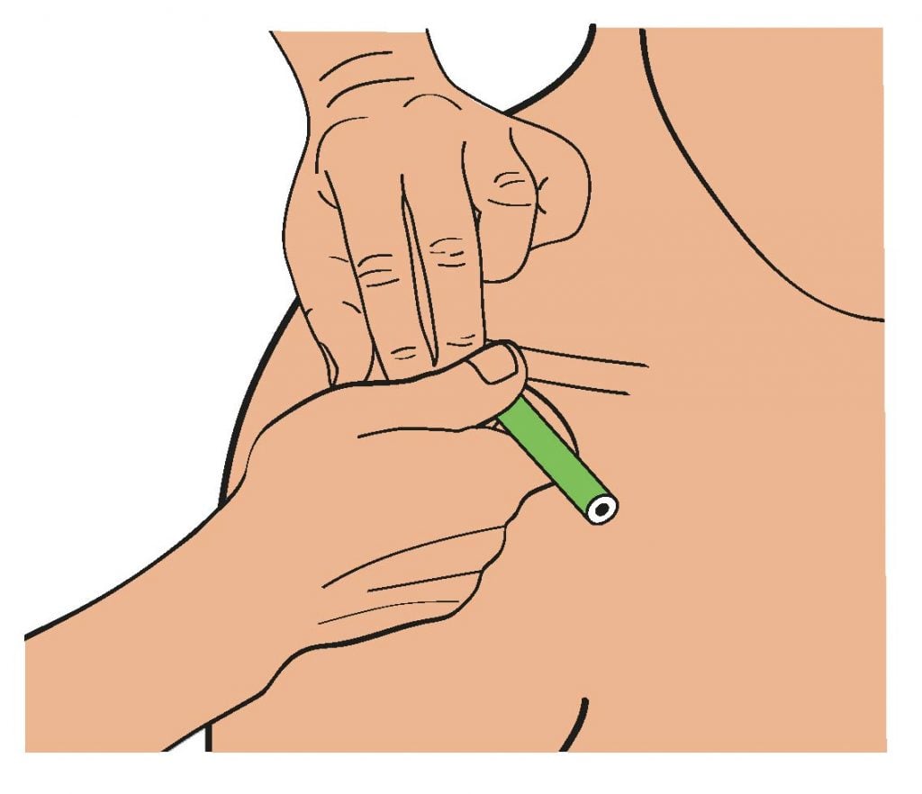 dessin de strapping d'épaule