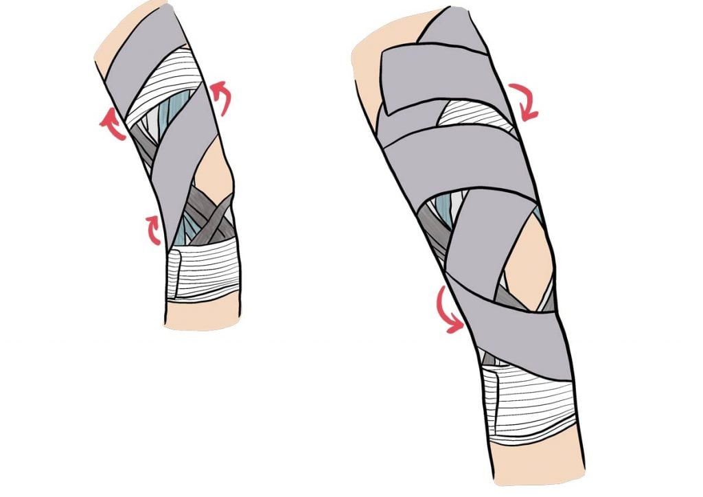 strapping-ligaments-croisés-1024x724