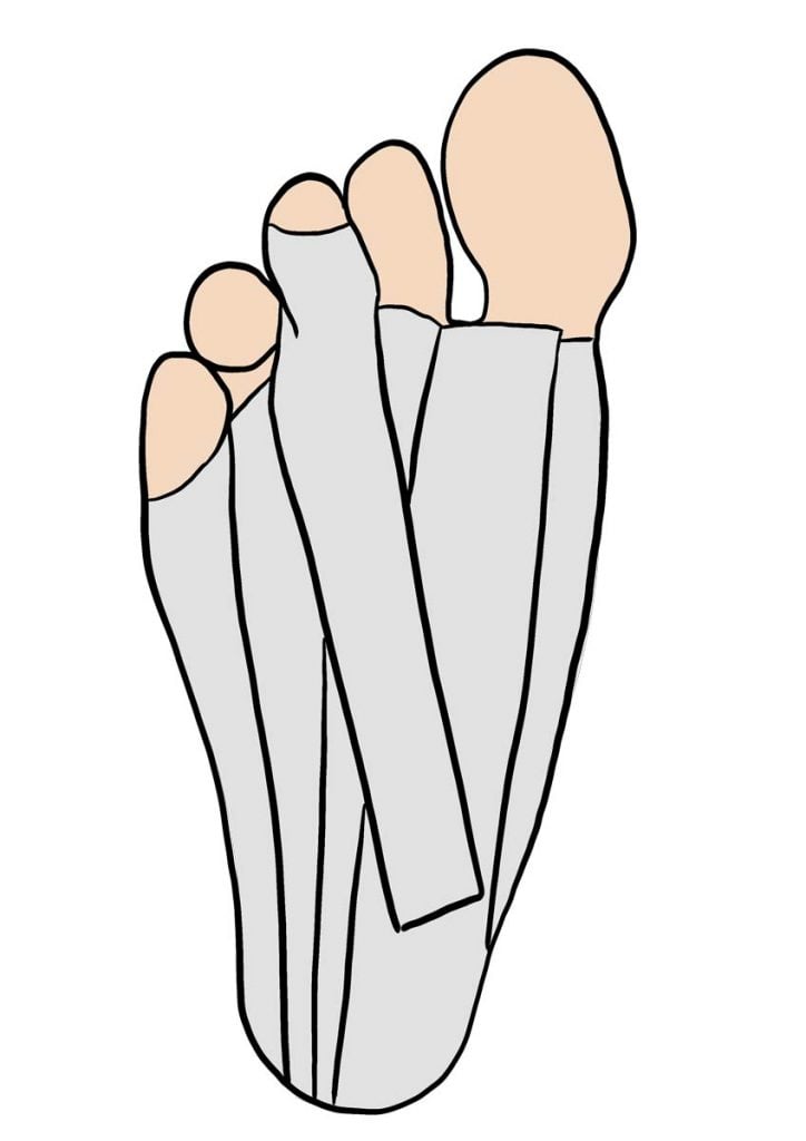 bandage voûte plantaire