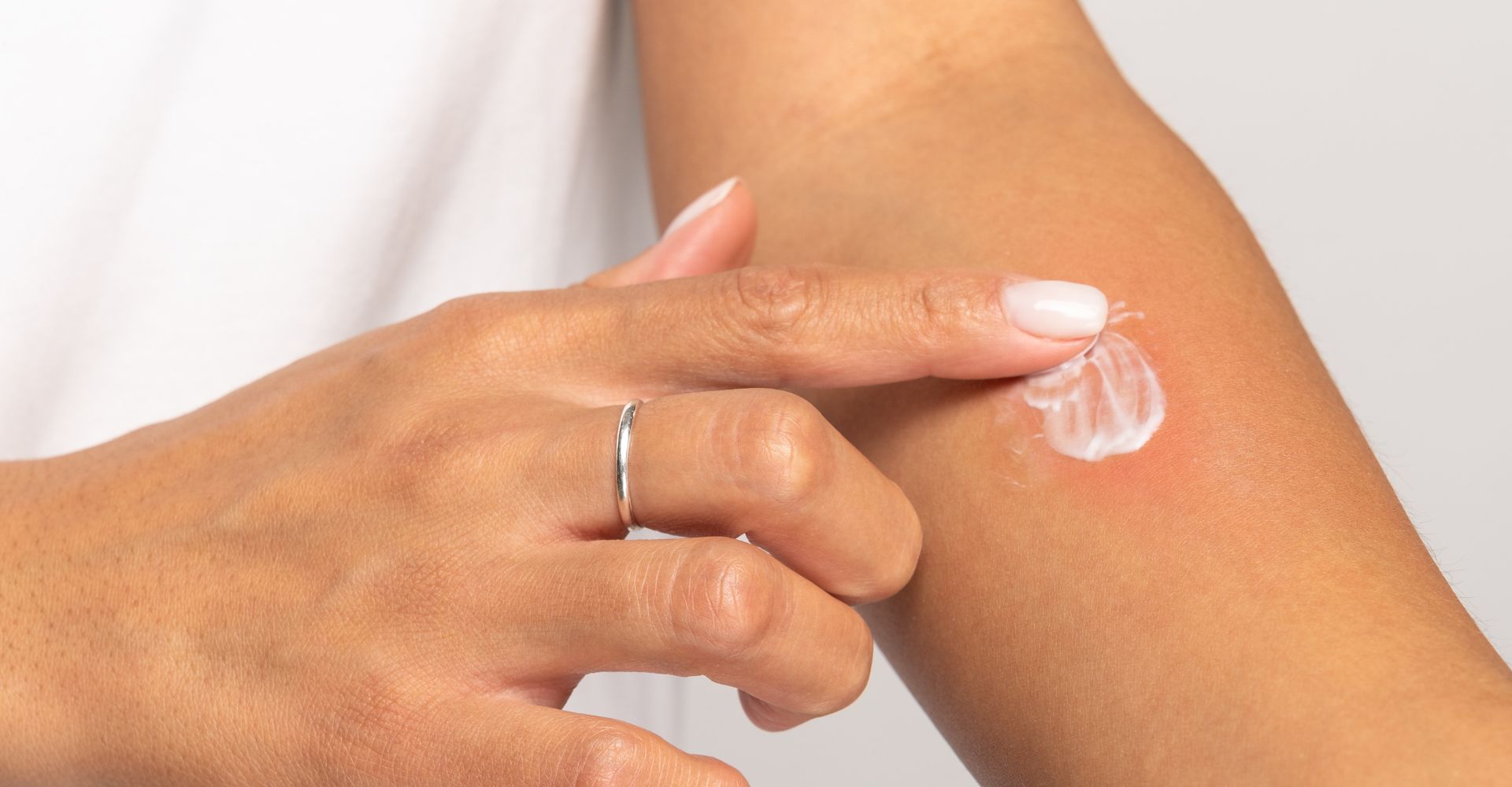 creme-demangeaison-piqure creme-demangeaison-piqure