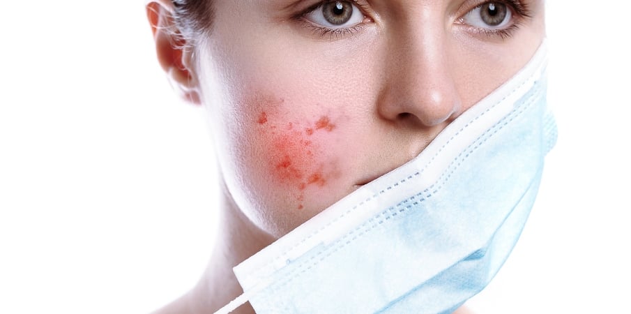 Comment prendre soin de sa peau sensible en période de pandémie ?