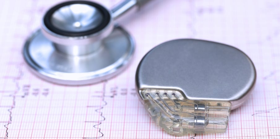 Comment fonctionne un défibrillateur cardiaque implantable ?