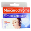 Sutures adhésives Mercurochrome