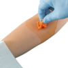 Lingettes chlorhexidine orange pour désinfection