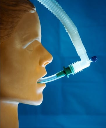 intubation