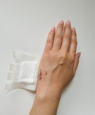 suture à fil