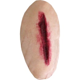 Plaie hémorragique filet